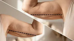 Heiluvat käsivarret? 3 helppoa harjoitusta personal trainerilta